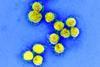 Coronavirus - National Institute of Allergy and Infectious Diseases